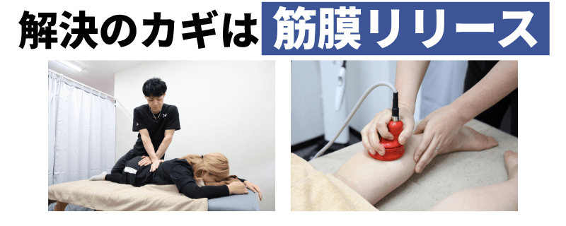 解決の鍵は筋膜リリース